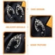 thumbnail image 3 of 1 par de pendientes de elfo sin perforaciones, con clip y accesorios para las orejas., 3 of 4