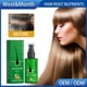 thumbnail image 1 of 30ml Ginger Hair Growth Spray Serum Anti Pérdida de cabello Reparación de la calvicie Cuidado del cabello Likrtyny Cuidado Belleza, 1 of 5