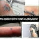 thumbnail image 2 of Waterproof Transparent Adhesive Bandage Bathing Swimming Transdermal Patch Water, 2 of 5