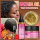 thumbnail image 2 of Aceite de crecimiento Batana 100 % natural y puro para el cabello, mascarilla capilar para la alopecia, tratamiento anticaída y anticaída., 2 of 5