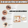 thumbnail image 4 of Crema para ojos antiarrugas, elimina instantánea, bolsas para ojos, ojeras, crema firme antihinchazón debajo de los ojos, aclaramiento de líneas finas, hidratante, 4 of 5