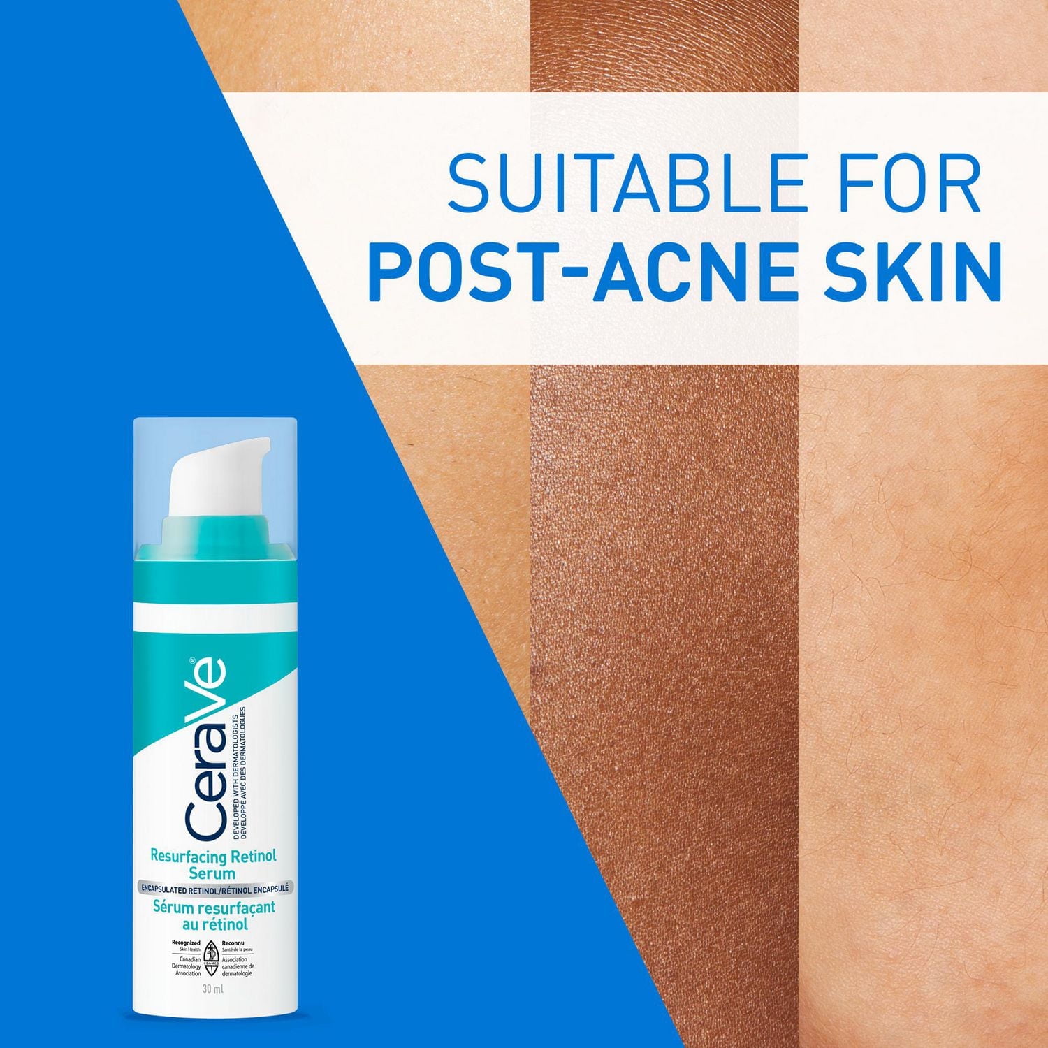 CeraVe Resurfacing Retinol Serum for Face with Niacinamide & Encapsulated Retinol. Helps even Skin Tone, Improve Skin Smoothness & Reduce Post-Acne Marks. Gentle, Fragrance-free, & Non-Comedogenic, 30, A full-face lightweight serum