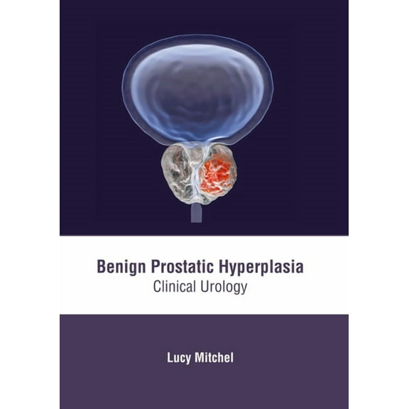 Benign Prostatic Hyperplasia: Clinical Urology, (Hardcover)
