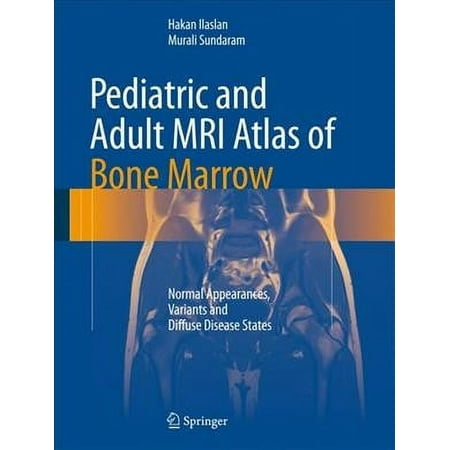 UPC: 9783642027390 | Pediatric and Adult MRI Atlas of Bone Marrow : Normal Appearances Variants and Diffuse Disease States (Hardcover)