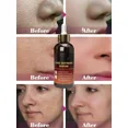 thumbnail image 5 of Esencia que encoge los poros, repara los poros grandes, ilumina el cuidado Facial de larga duración, 5 of 5