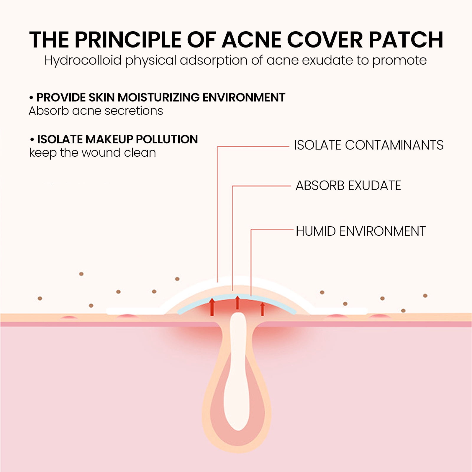Alvantor Pimple Patches for Face with Tea Tree, Hydrocolloid Acne, Hurt Zit Covers, 200 Count