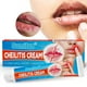 thumbnail image 3 of Wartleves Crema para la queilitis Inflamación Herpes labial Antibacterianos Ungüento para labios, 3 of 6