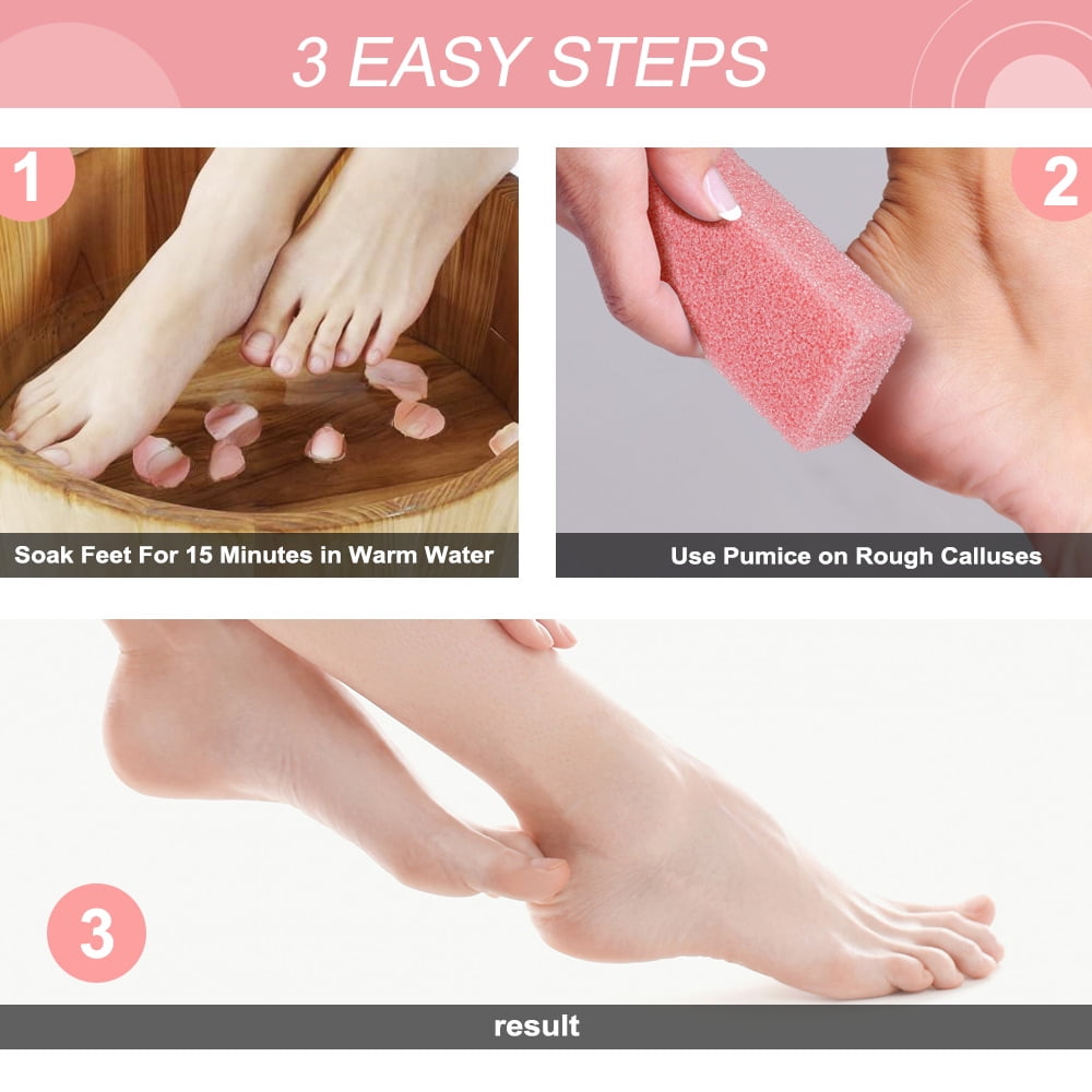 3/5pcs Reusable Foot Pumice Sponge Stones Foot Care Callus