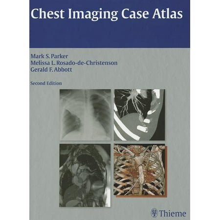 UPC: 9781604065909 | Chest Imaging Case Atlas (Hardcover)