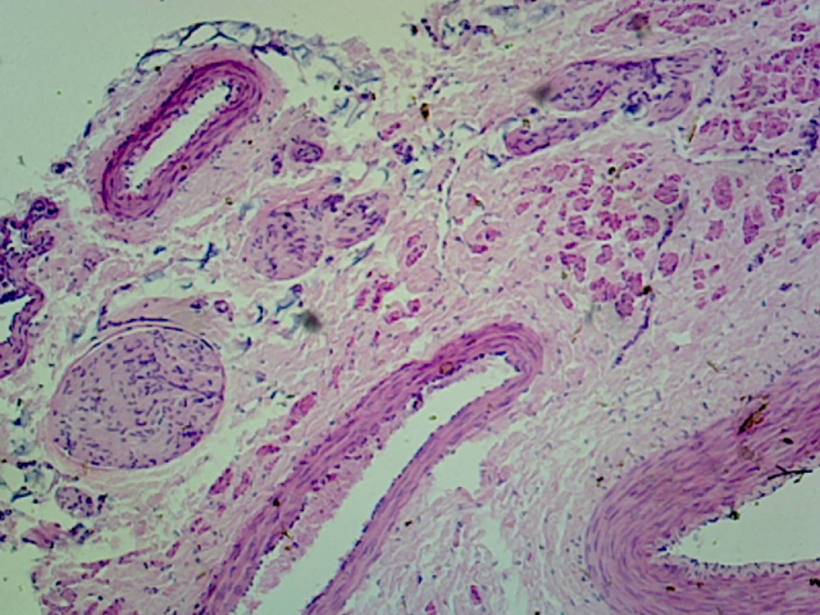 GSC International PS0190 MediumSized Artery and Vein, Human; Cross