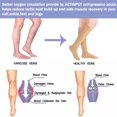thumbnail image 2 of 2 Pairs Open Toe Zipper Medical Sport Copper Compression Socks With Anti-slip Silicone for Women & Men Circulation 15-20 mmhg is Best Support for Athletic Running Cycling, Nursing, Travel, 2 of 6