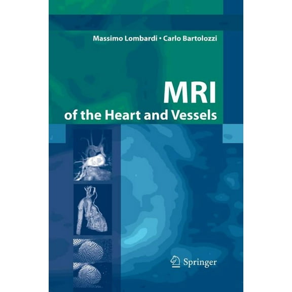 MRI of the Heart and Vessels, (Paperback)
