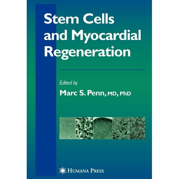 Contemporary Cardiology Stem Cells and Myocardial Regeneration, (Paperback)