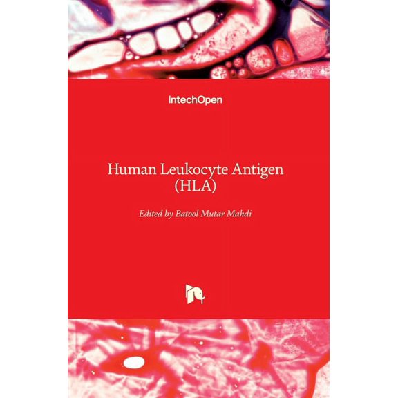 Human Leukocyte Antigen (HLA) (Hardcover)