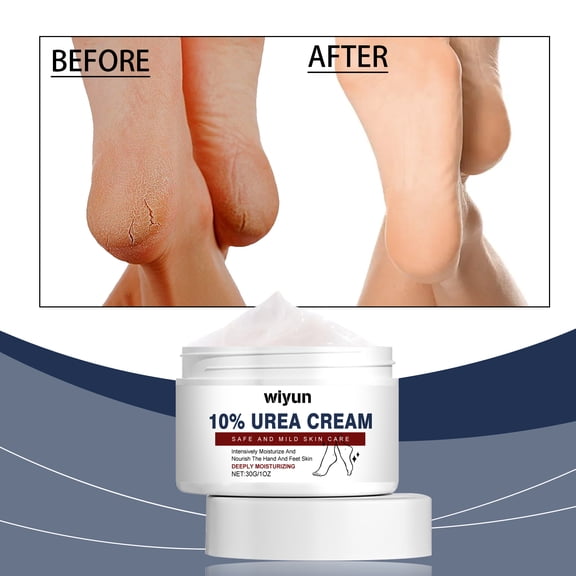 Wiyun 10 Urea Cream, Exfoliating Hydrating Repair Care Skin Skin Care Cream