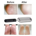 thumbnail image 4 of Foot Filer Coarse Callus Remover Stainless Steel Pedicure Scraper Foot Care, 4 of 5