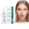 thumbnail image 2 of Facial Chemical Exfoliating Is Applicable To Acne And Freckle Removal To Improve Pore Size And Even Skin Color, 30ML, 2 of 4