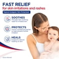 thumbnail image 3 of Resinol Medicated Ointment for Pain Relief and Protection of Skin Irritations, 1.75 oz, 3 of 9