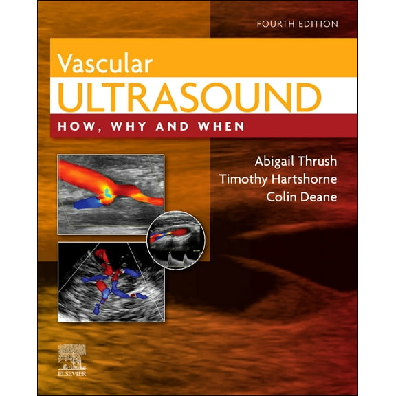 Vascular Ultrasound
