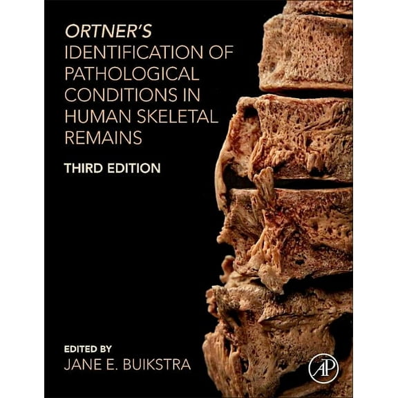 Ortner's Identification of Pathological Conditions in Human Skeletal Remains, (Hardcover)