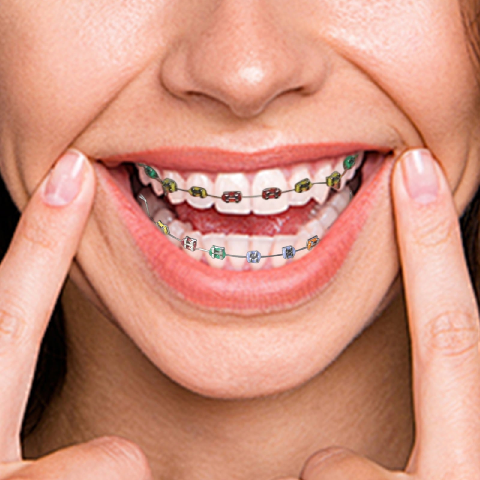 Fake Braces,Kids Fake Braces Lip Protector Colorful Braces Wire,Teeth Braces Wire Stylish Teeth Cosplay Braces for Dentists Kids
