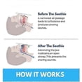 thumbnail image 5 of 2025 Honex Anti Snoring Mouthpiece The Quite Night Device for Snore Reduction and Better Sleep, 5 of 5