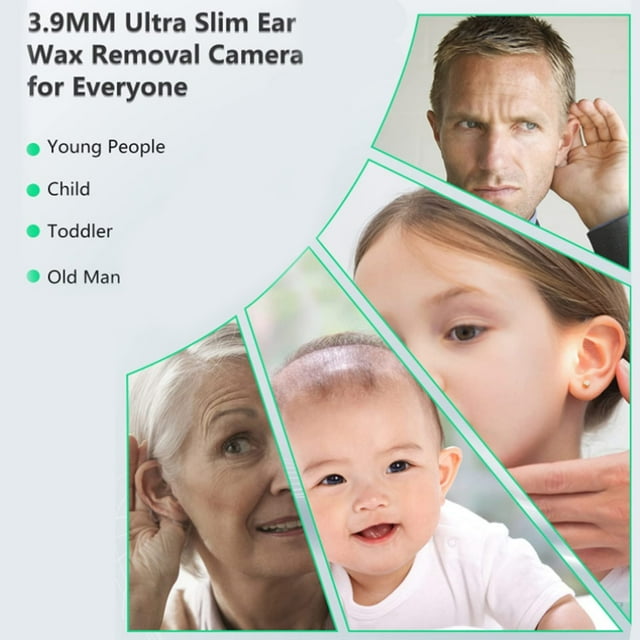 Otoscope Ear Wax Removal 330mAh Visual Digging Spoon Mini 3.0mm Thin Type-C Picking Mirror Temperature Control Endoscop Cleaning White