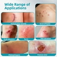 thumbnail image 6 of Dimora Hydrocolloid Roll 2" × 16',Medical Grade Hydrocolloid Bandages for Wound Care, Burn, Blister, Acne Care, Cut-to-Size, Ultra Absorbent, Waterproof, First Aid Kit Essential, 6 of 10