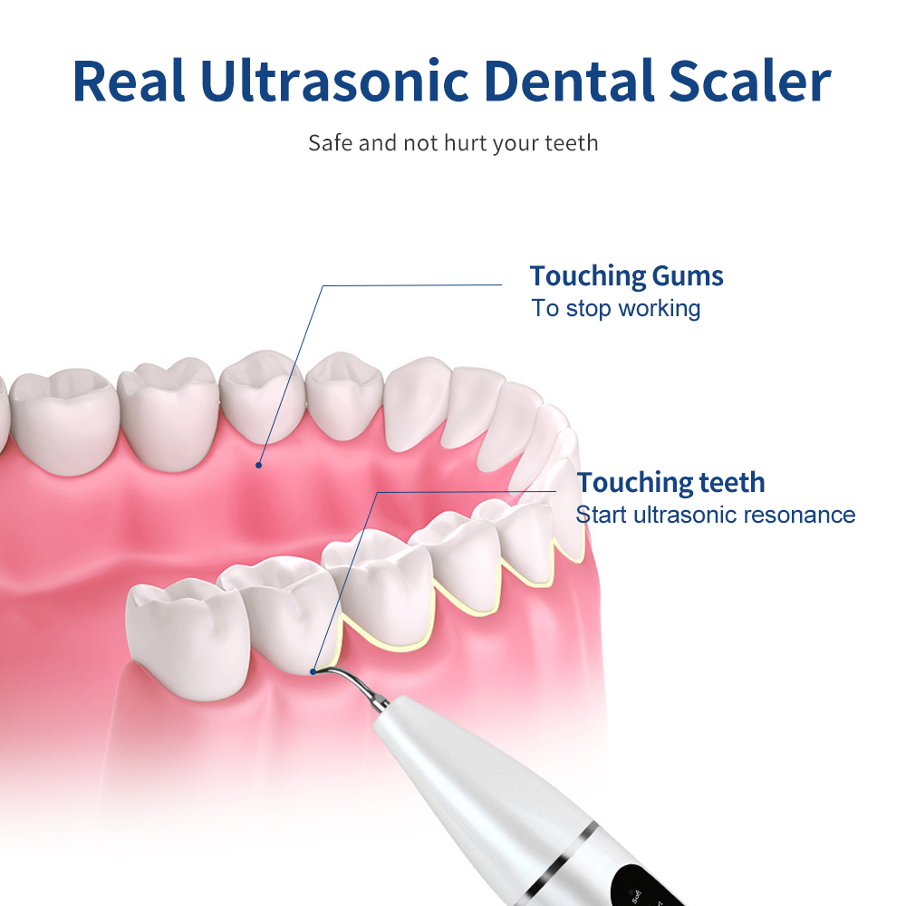 Ultrasonic dental scaler irrigator tartar eliminator teeth whitening stain plaque remover dental stone removal teeth cleaner