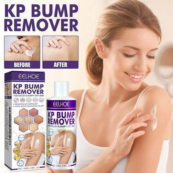 KP Bump Remover, KP Bump Eraser & Hydrating Cream – Chemically Exfoliates and Moisturizes with 10% Lactic Acid (AHA), Salicylic Acid, Citric Acid 3.38 fl. oz