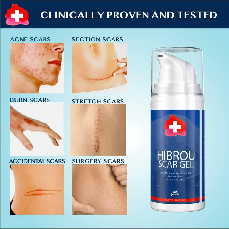 脱毛・除毛 EPI PHOTO SKIN CARE HIGH GRADE 未開封 ミュゼ EPI PHOTO SKIN CARE HIGH GRADE 2025年最新