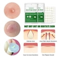 thumbnail image 5 of West&Month - Eliminador de acné transparente e invisible, cubierta absorbente de espinillas, pegatinas faciales para el cuidado de la piel, 2 tamaños (36 unidades), 5 of 5