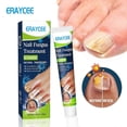 thumbnail image 1 of Fungus Nail Cream, Nail Repair Cream, Strong Anti-Fungal Toenail Cream,Nail Repair Nourishing Treatment,Restores Discolored and Damaged Nails 20g, 1 of 4