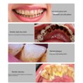 thumbnail image 1 of Removedor de cálculos dentales domésticos, irrigador dental, cepillo de dientes eléctrico, instrumento de belleza dental, luz fría, 1 of 4