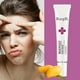 thumbnail image 3 of Crema facial para el tratamiento del acné, reparación de espinillas, Control de aceite, reduce los poros, cicatriz, hidratante, cuidado de la piel, cosméticos coreanos, cremas blanqueadoras Feliz Sencillez, 3 of 5