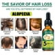 thumbnail image 4 of Productos para el cuidado del cabello Aceite de jengibre para el cuidado del cabello 30 ml, Líquido para el crecimiento del cabello Reduce la caída del cabello Cuidado del cabello un acondicionador, 4 of 5