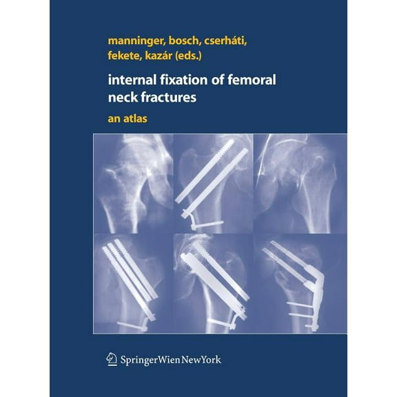 Internal Fixation of Femoral Neck Fractures: An Atlas, (Hardcover)