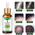 thumbnail image 3 of IBeaLee Herbal Hair Growth essence Hair Oil Hair Growth Agent Hair Nutrition Liquid, 3 of 5
