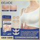 thumbnail image 2 of 8 Pack Silicone Scar Sheets For Breast Reduction Surgery Aftercare With 4 Areola Strips And 4 Anchor Strips, 2 of 3