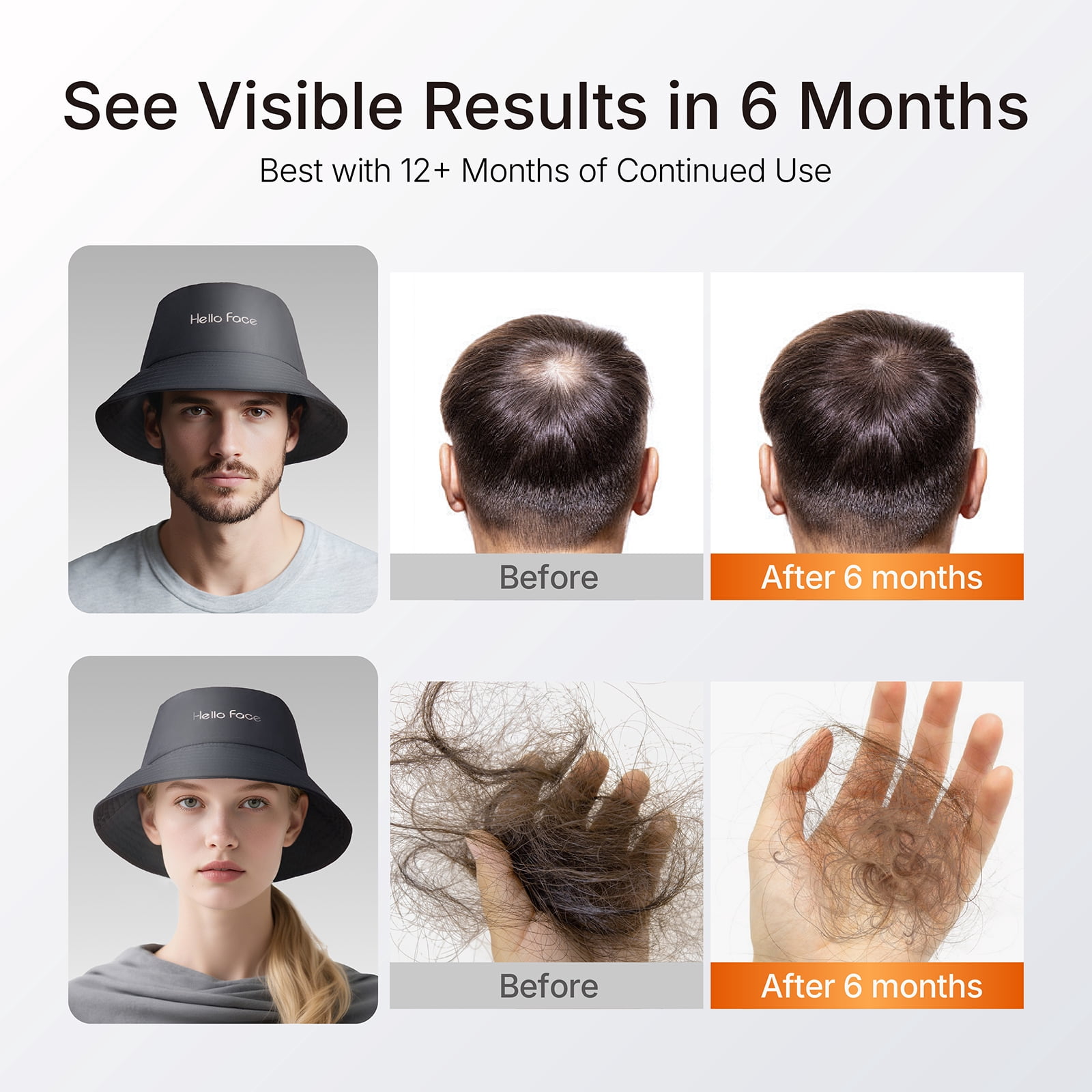 Dr.pedi Red Light Therapy Hair Growth Cap with 336 LEDs 660nm & 850nm, Discreet Fisherman Hat Design Fits up to 24.4", Full Scalp Coverage for Men & Women