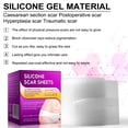 thumbnail image 4 of Medical Grade Silicone Scar Sheets - Reusable Transparent Silicone Scar Tape Roll for Old & New Scars, Burns & Scalds, Surgical Scar, 1.6" X 60", 4 of 10
