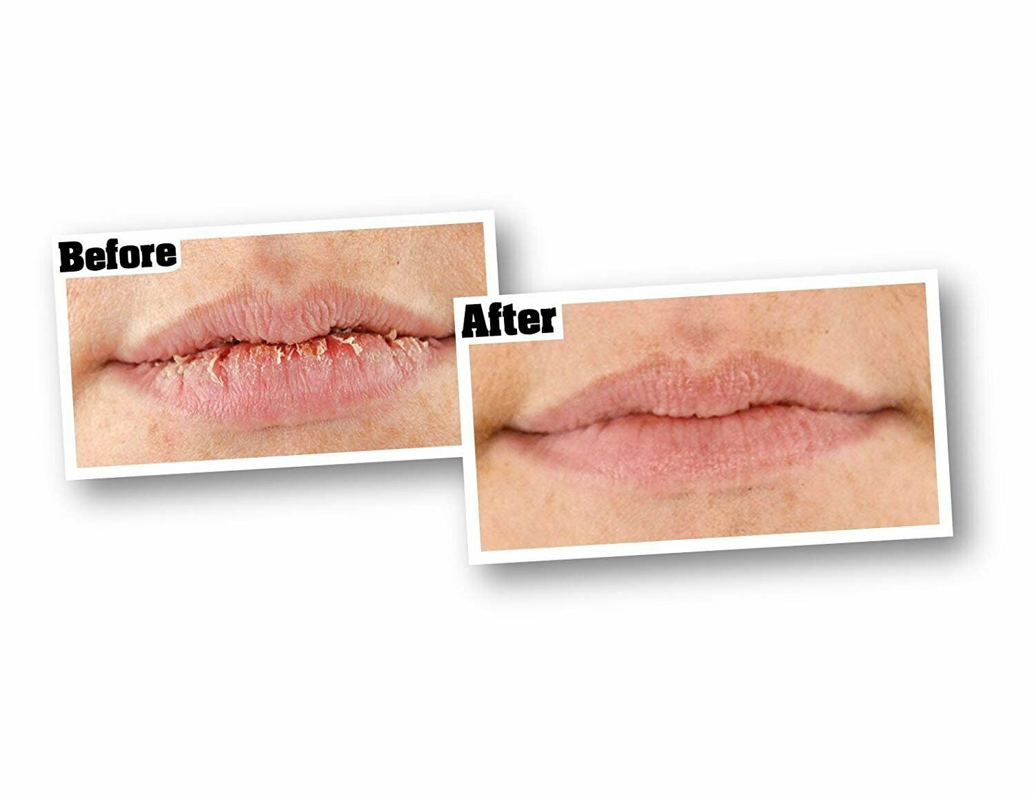 Original Lip Repair 0.15oz