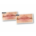 thumbnail image 2 of Original Lip Repair 0.15oz, 2 of 10