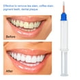thumbnail image 1 of Gel Blanqueador De Dientes ANGGREK 5ml 35% De Peróxido De Hidrógeno Doble Barril Blanqueamiento Dental Cuidado Bucal, 1 of 8