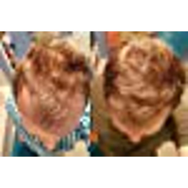 DIY AHK Copper Peptide Solution AHK-Cu Scalp Hair - Walmart.ca