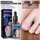 thumbnail image 4 of Toenail Nail Fungus Treatment Repair Fingernail Device Toenail Treatment for Foot Nail Fungus Essential Oil Onychomycosis Care, 4 of 5
