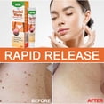 thumbnail image 4 of Crema para herpes Genital FLhrweasw 20g ingredientes naturales tratamiento de condiloma acuminatum, 4 of 9