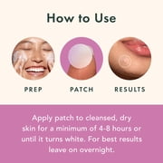 Rael Beauty, Miracle Blemish Patch Overnight Spot Cover, 26 Count
