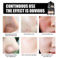 thumbnail image 4 of Peel Off Blackhead Remove Yeso Nariz Pull Suministro de máscara negra para mujeres Belleza, 4 of 7