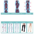 thumbnail image 3 of Los calcetines de compresión previenen las venas varicosas, los calcetines con punta abierta en el muslo, medias de soporte, 3 of 8